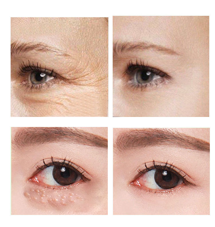 Eye Cream